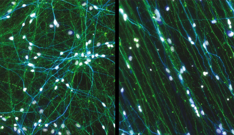 Bioengineered neuronal 'circuit board' mimics conditions of the human brain