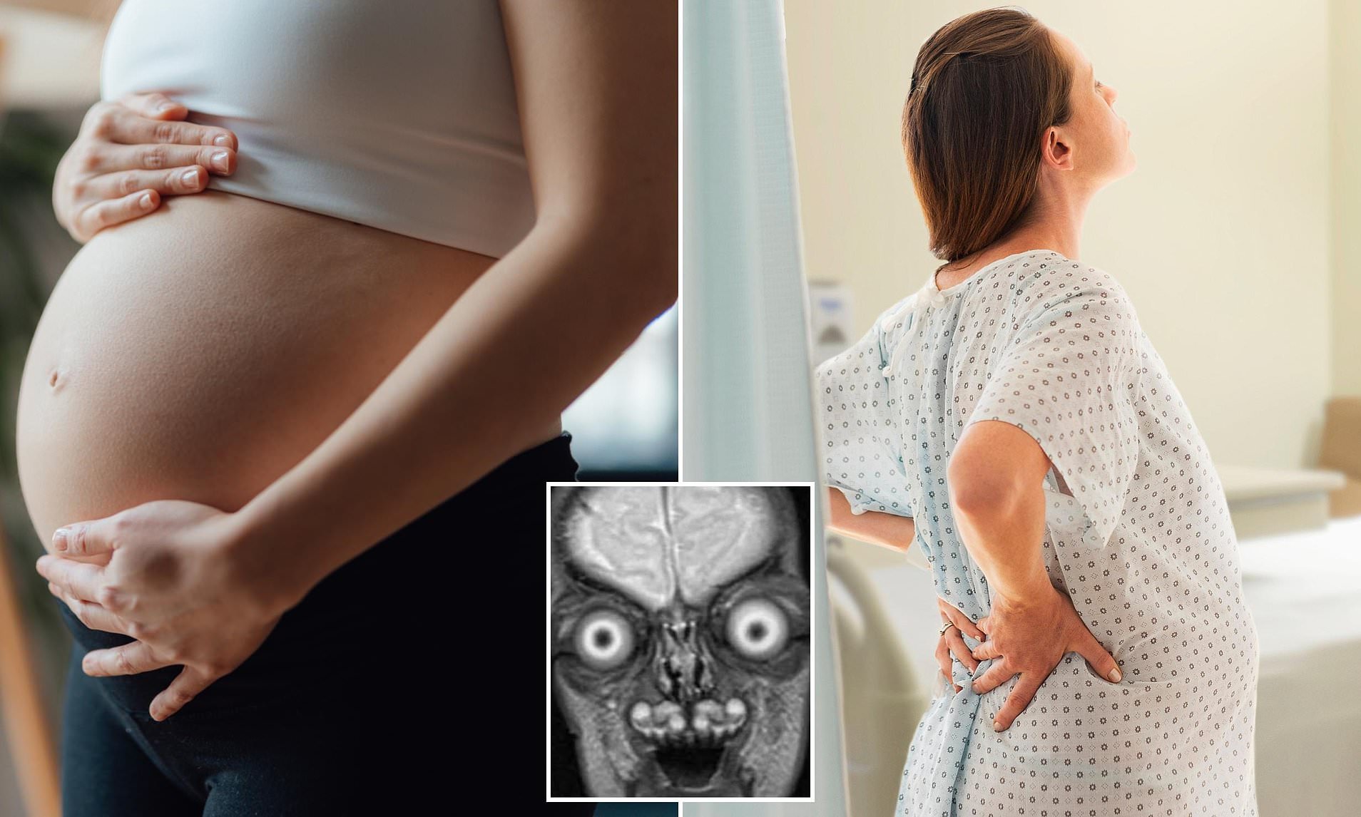 Disturbing images reveal the worrying truth behind performing MRIs in ...