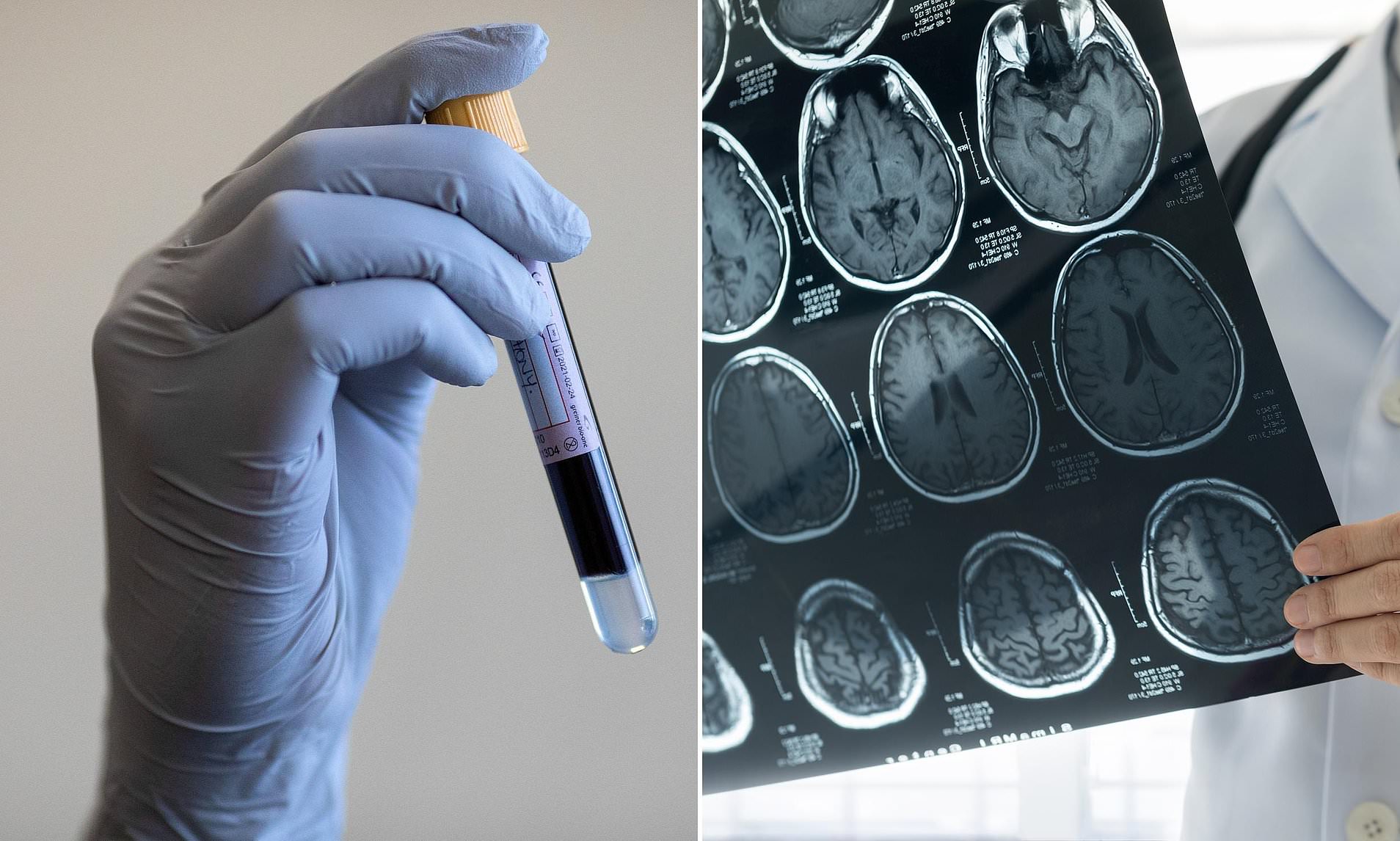 Patients with deadly brain tumours being denied life-saving genetic ...