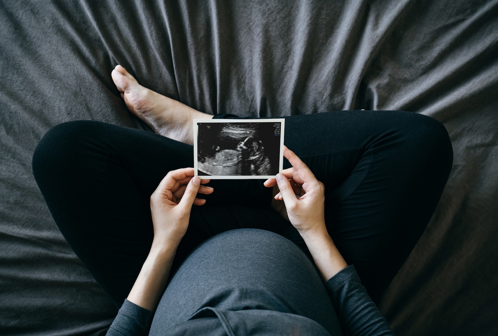 Early pregnancy care declines despite Trump’s pro-birth agenda