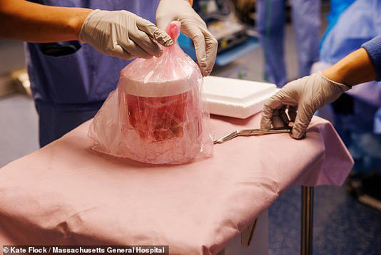 Pictured is the genetically-edited pig kidney that was transplanted into Andrews. He lived with it for 271 days