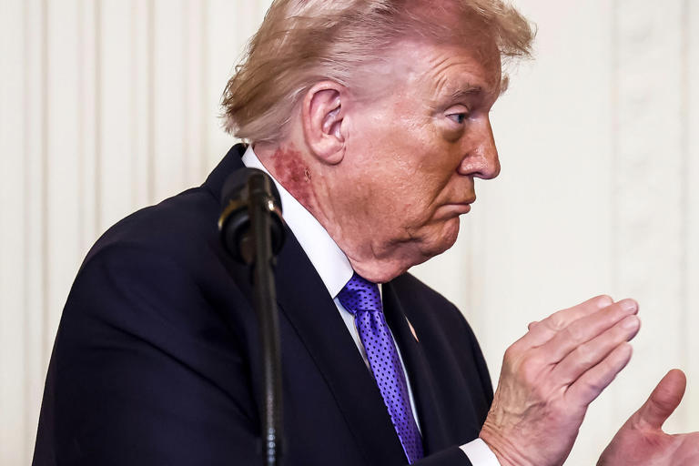White House addresses 'redness' on the side of Trump's neck