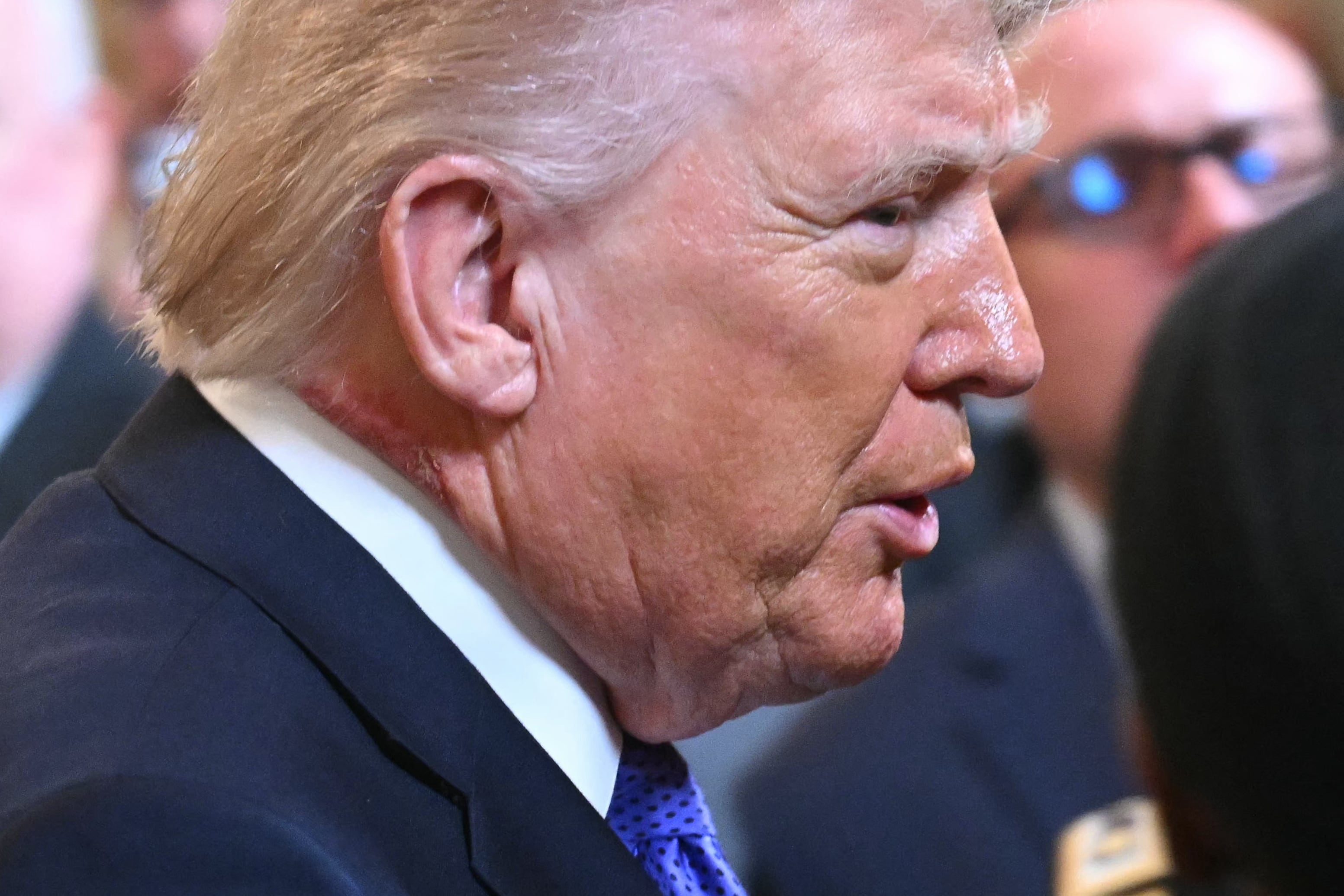 White House sparks more questions with odd Trump rash claim