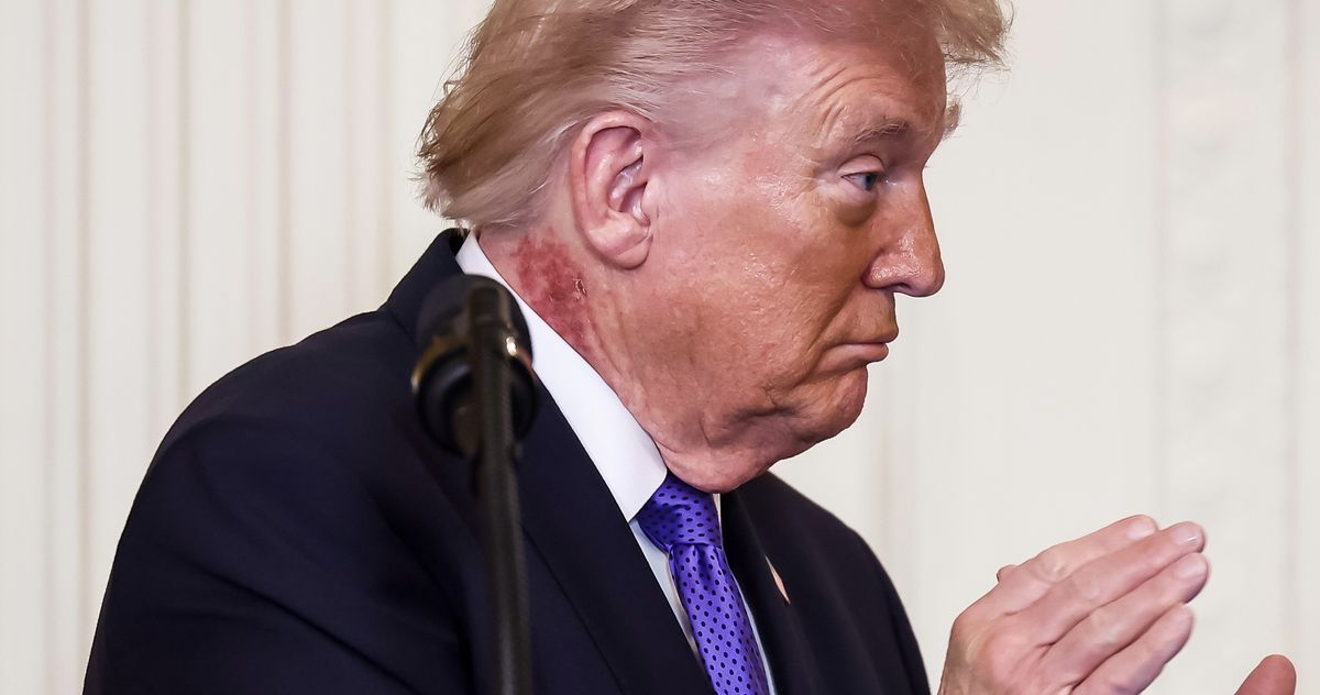 President Trump has a weird new rash