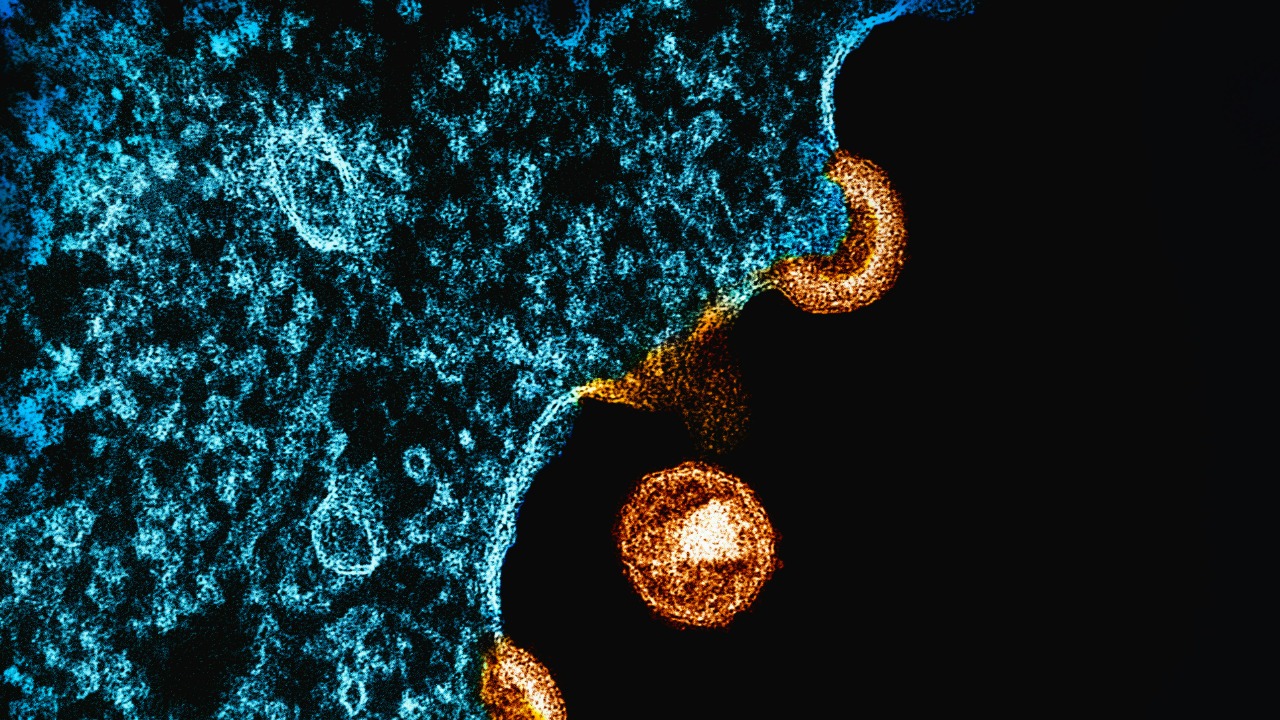 Engineered immune cells obliterate brain metastases in early lab tests