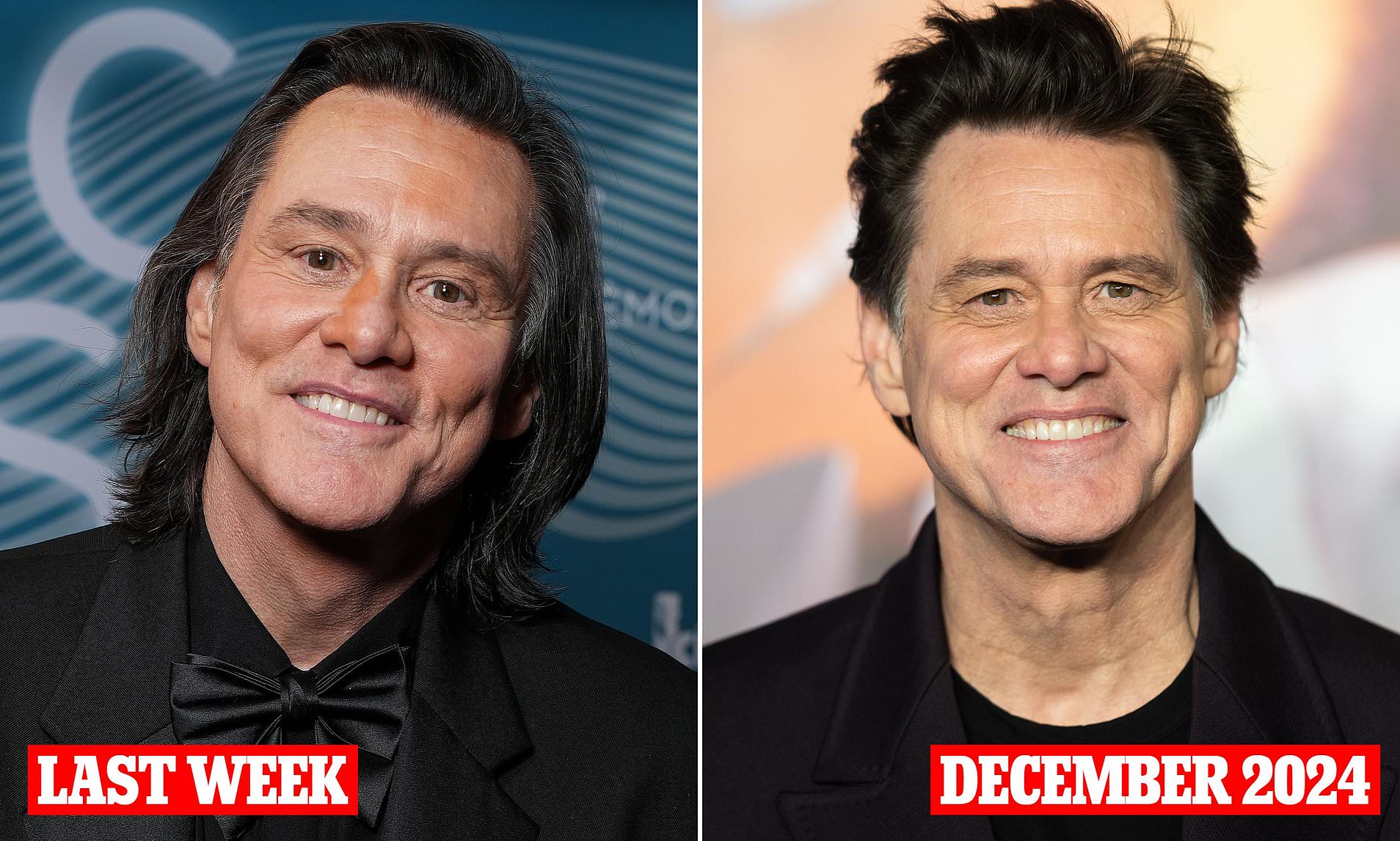 What has Jim Carrey done to his face? Plastic surgeons' verdict on star ...