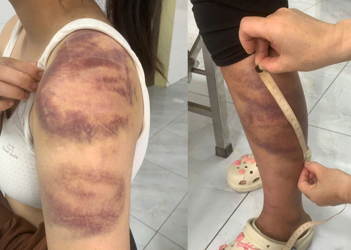 Đánh con gái và vợ mang thai 'như thời trung cổ'