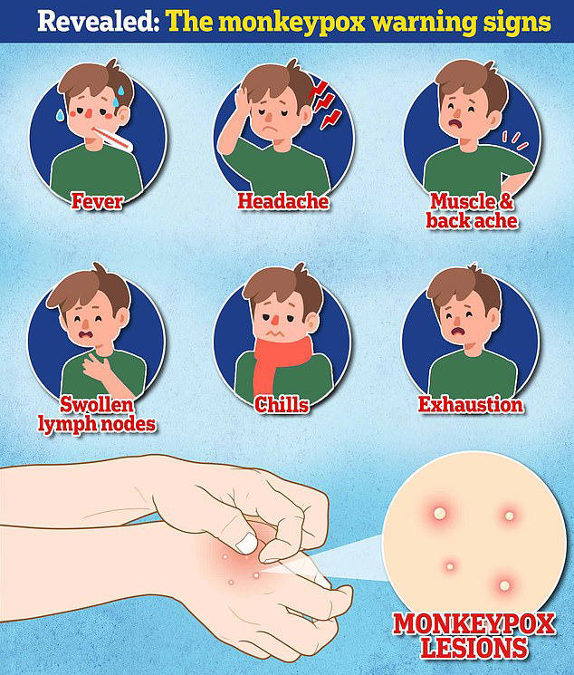 Travel warning issued as cases of mpox rise in Spain