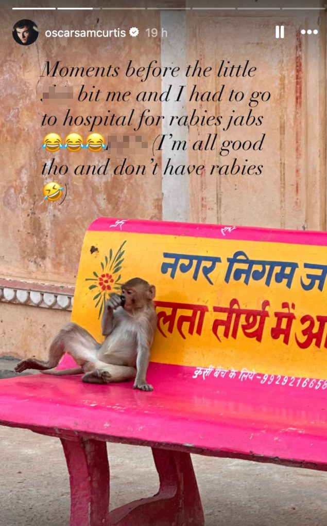 Hollyoaks Lucas Hay star hospitalised after being bitten by monkey