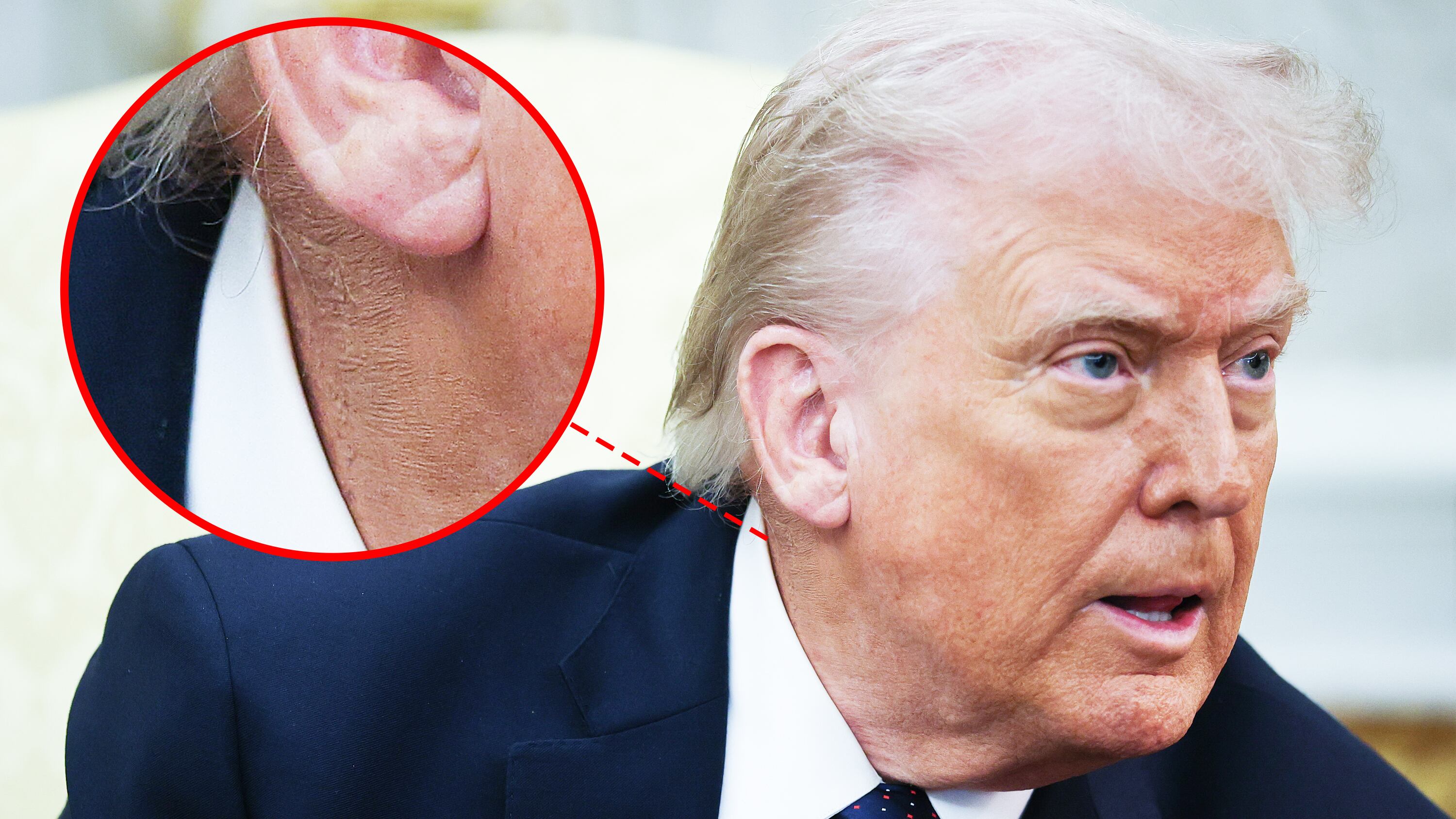 Trump, 79, uses favorite fix to battle new health problem