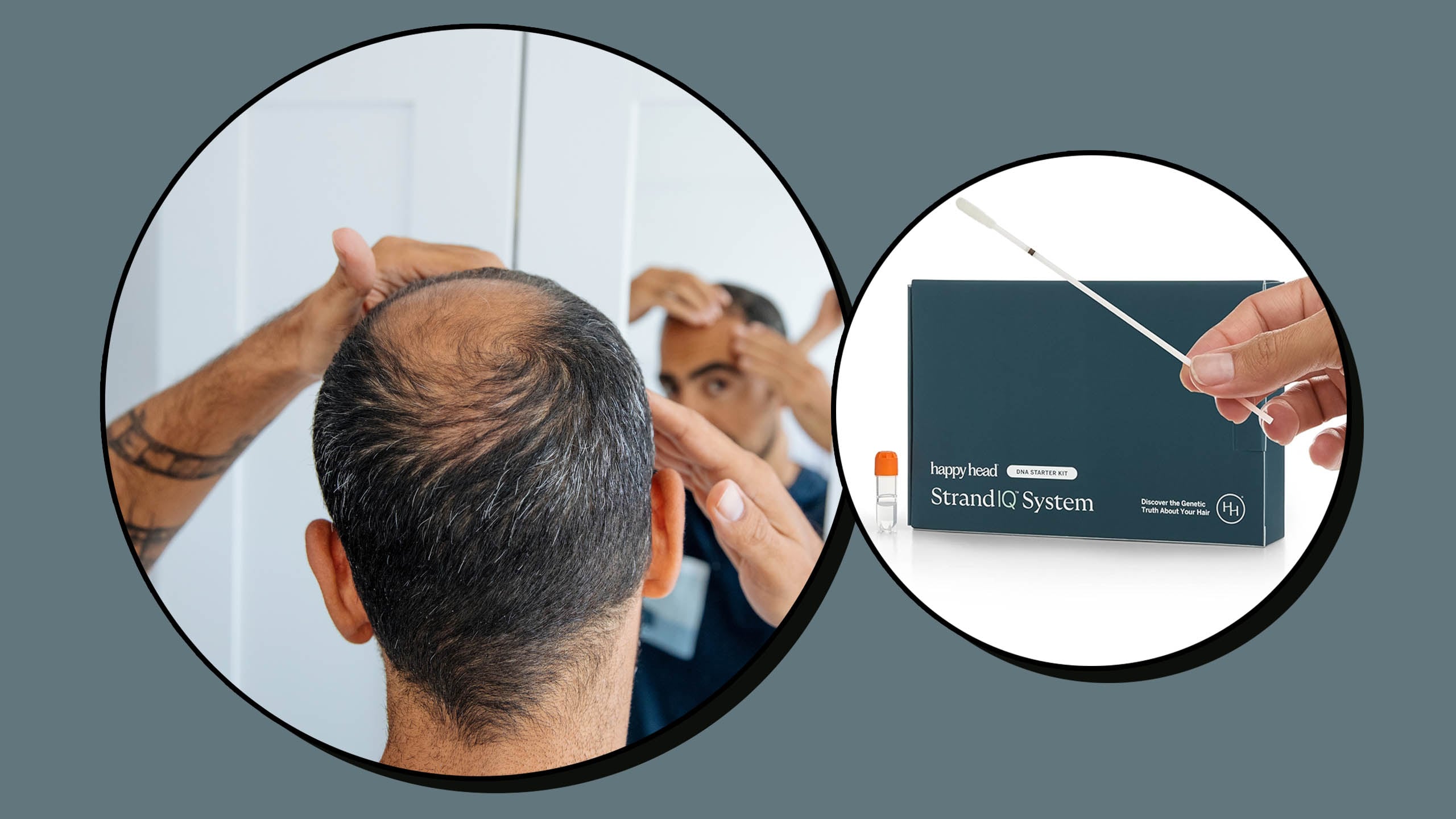 Scouted: I took a DNA test to identify the cause of my hair loss—here’s ...