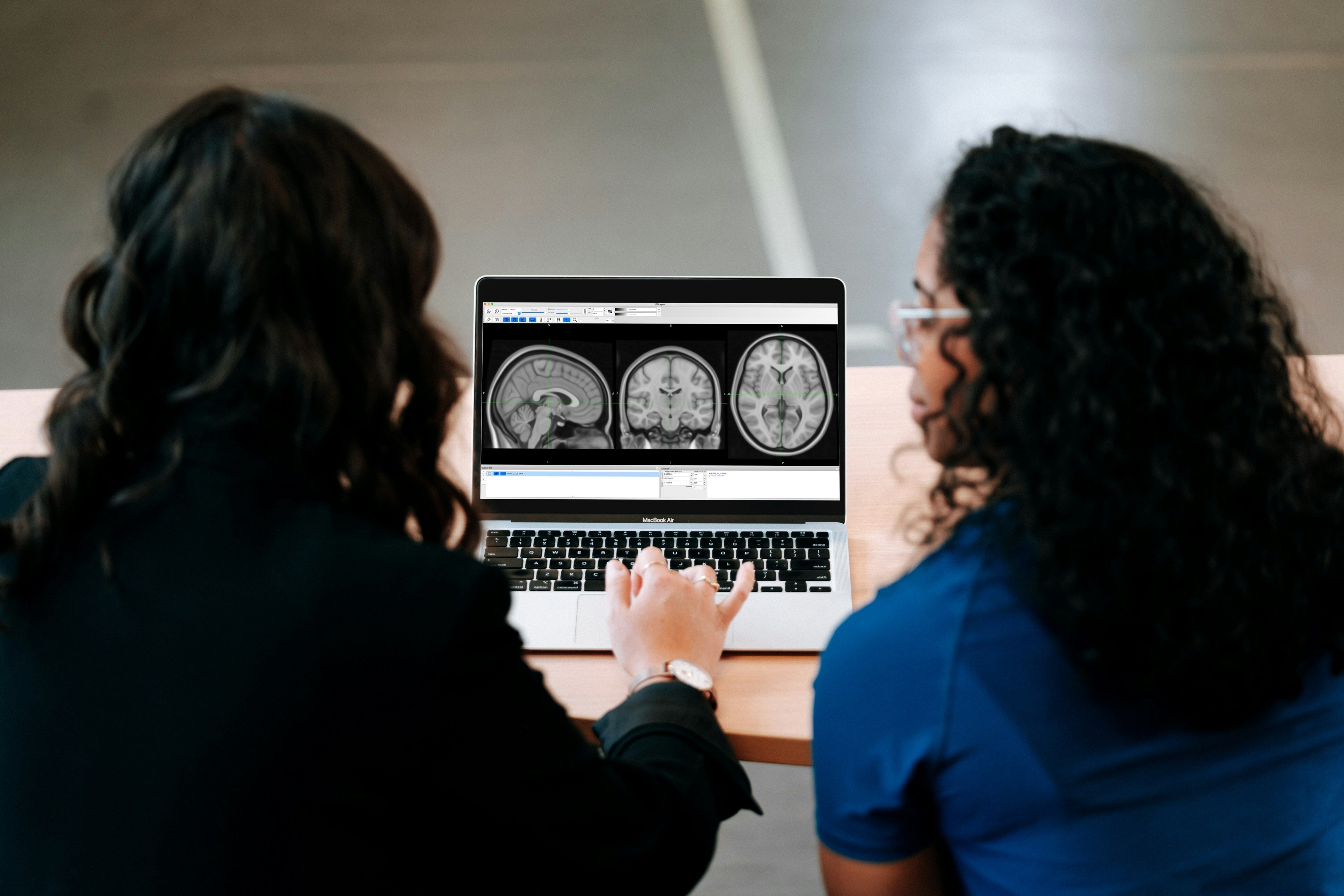 After hundreds of brain scans, researchers found three types of ADHD