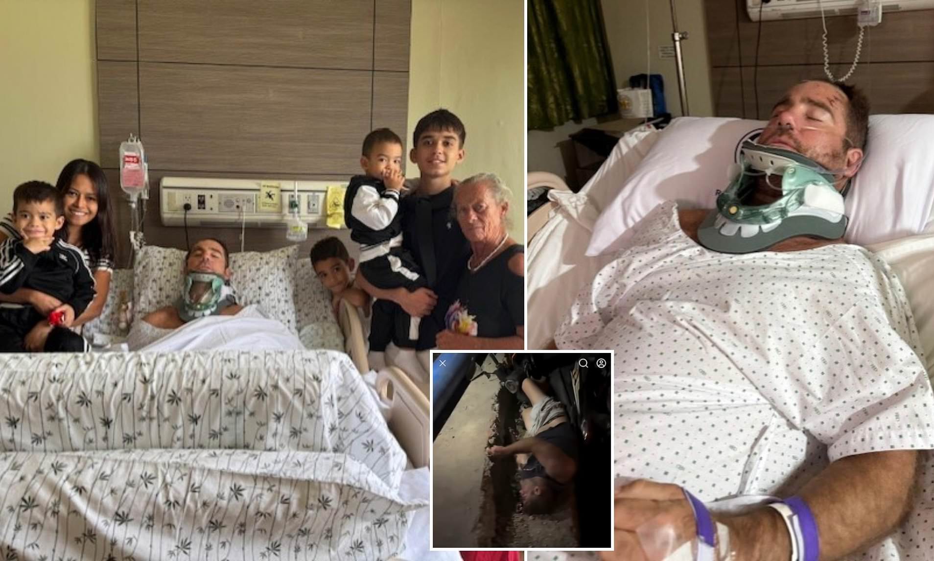 Aussie is left with horrific injuries in the Philippines after a common ...