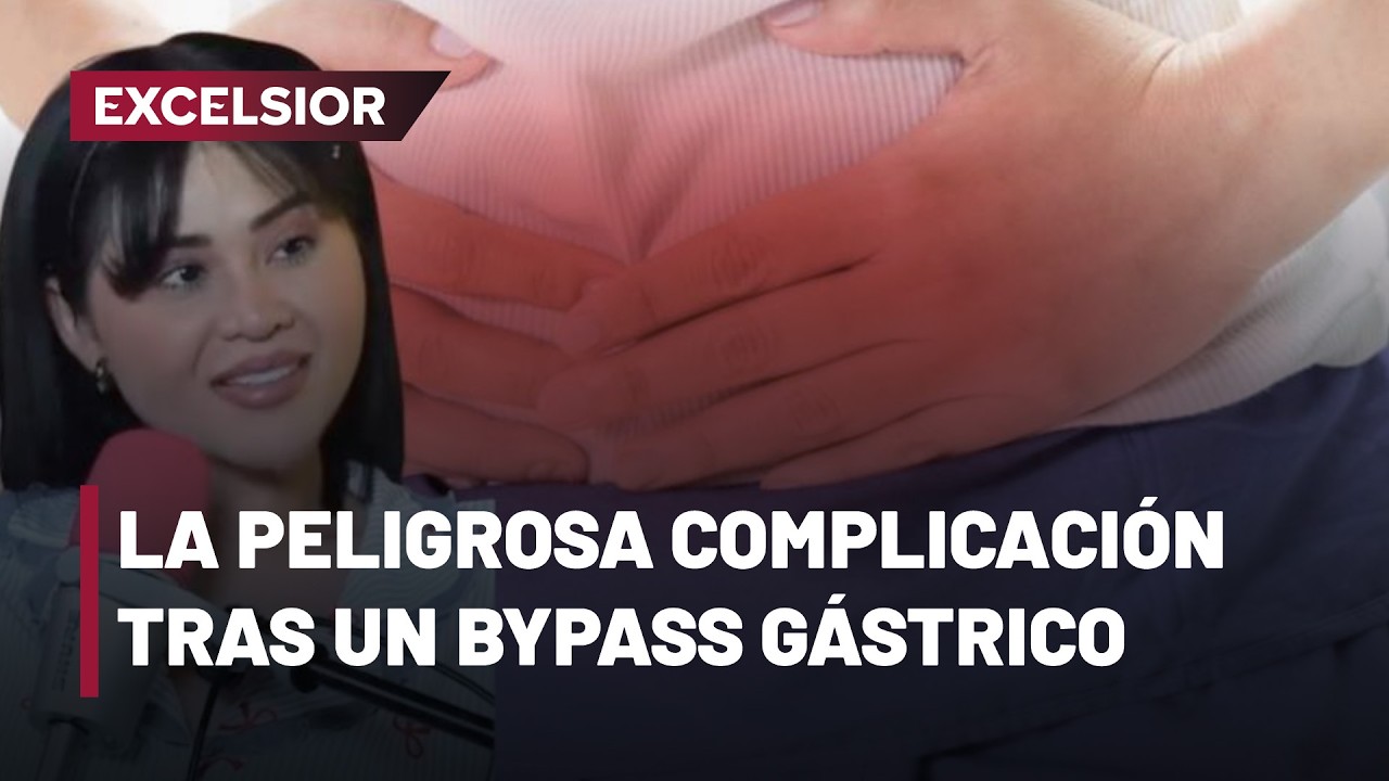 La hernia de Petersen, complicación del bypass gástrico