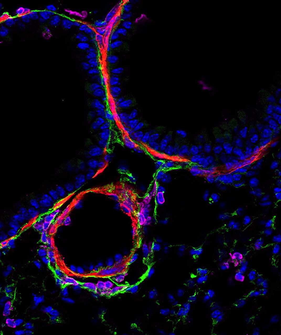 Microbe fragments 'train' lungs to resist allergies for months, study finds
