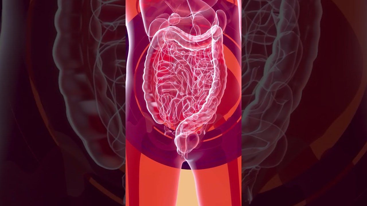 La hernia de Petersen, complicación del bypass gástrico