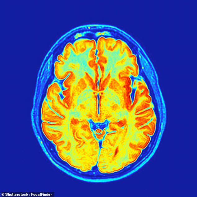 'Baby brain' is no joke - it does exist, study finds