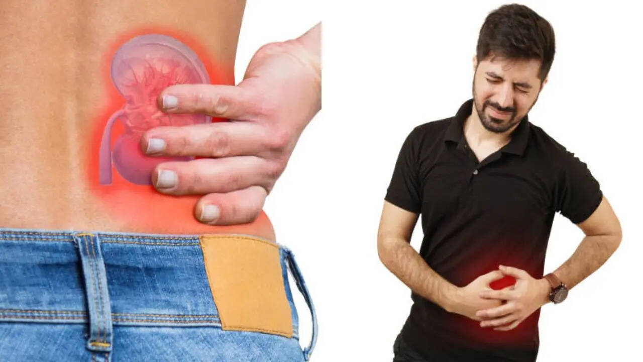 Kidney stones aren’t a one-time problem: Experts warn of 50% recurrence ...
