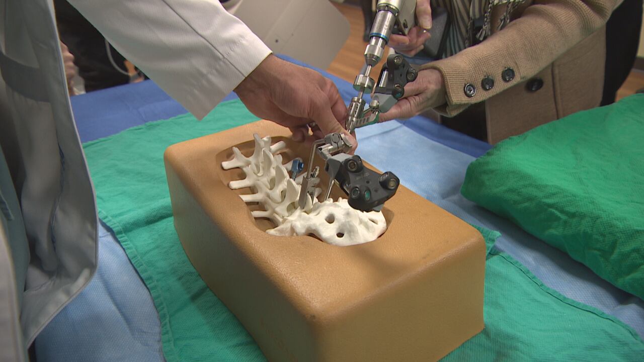 Winnipeg boosting spine surgeries with world-class technology
