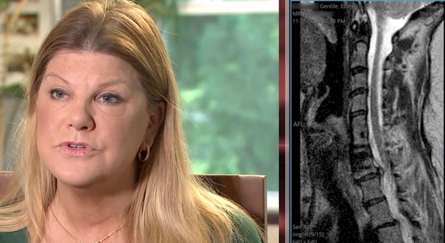 NJ mom prepped for surgery, gown on, IV in — then the hospital tried to back out. She ended up owing $126K for an operation she thought was approved<br><br>