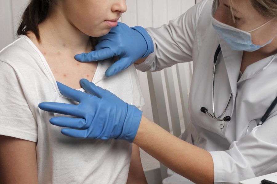 Second measles case confirmed in Kane County involving vaccinated person