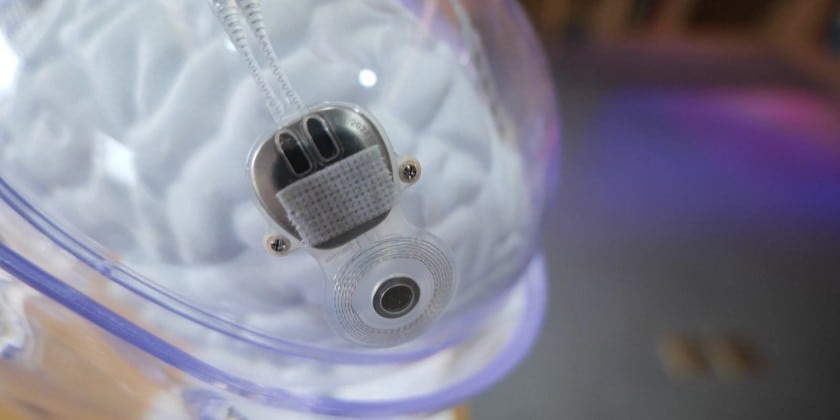 China first to approve invasive BCI device for commercial use