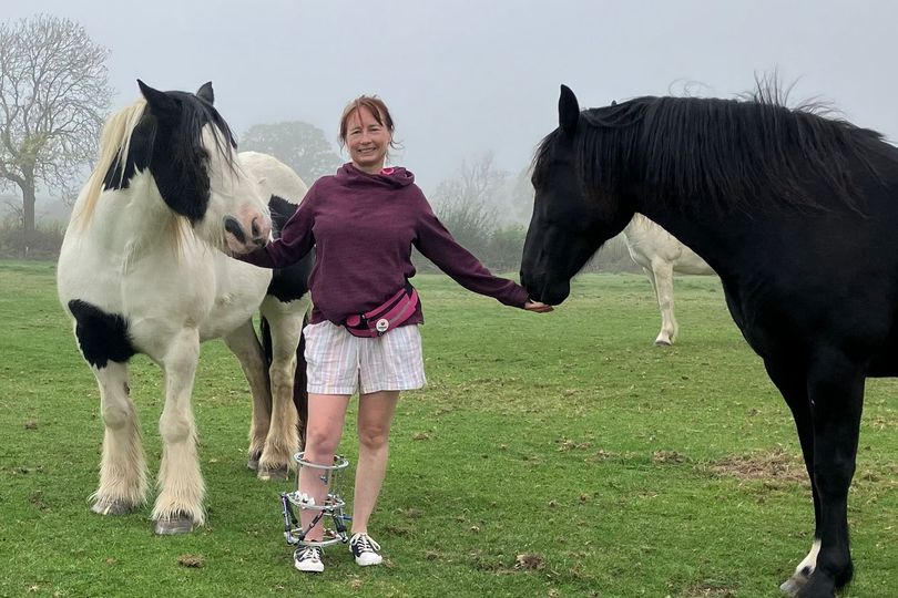 Woman who suffered severe leg injury in horse riding accident walks again
