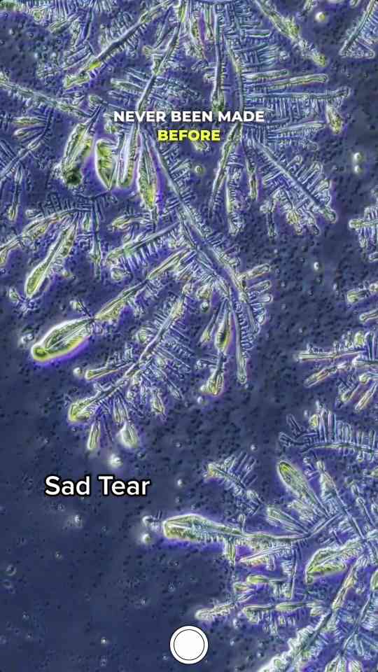 Crystallized tears seen up close under microscope