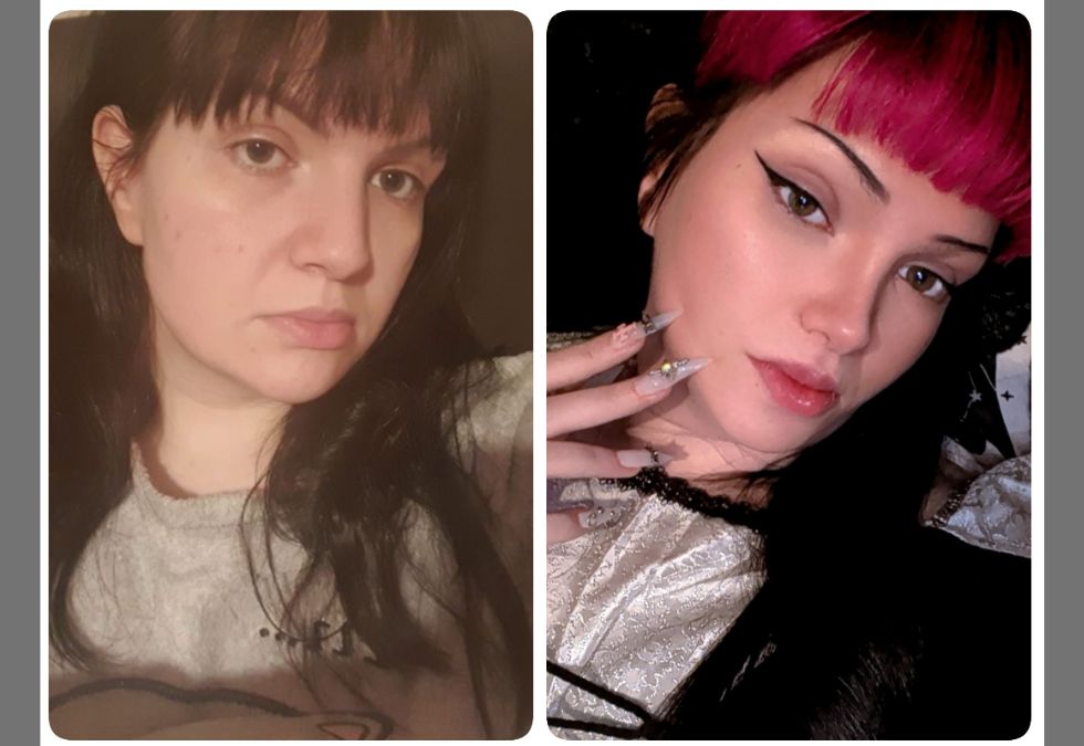 13 people who transformed their looks with plastic surgery