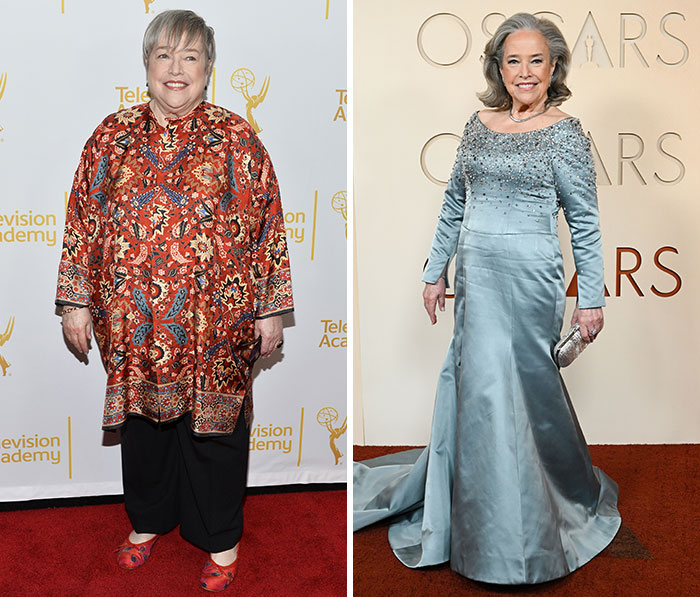 Oscars red carpet stuns fans as plastic surgery and weight loss side ...
