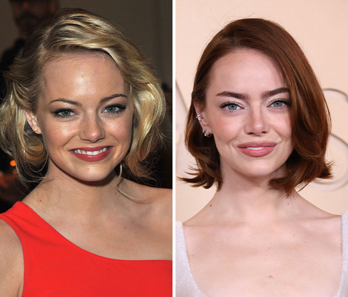 Oscars red carpet stuns fans as plastic surgery and weight loss side ...