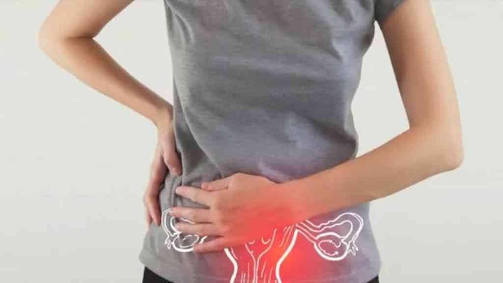 Endometriose afeta milhões de brasileiras, entenda