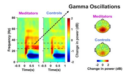 Meditation can counter age-related mental deterioration