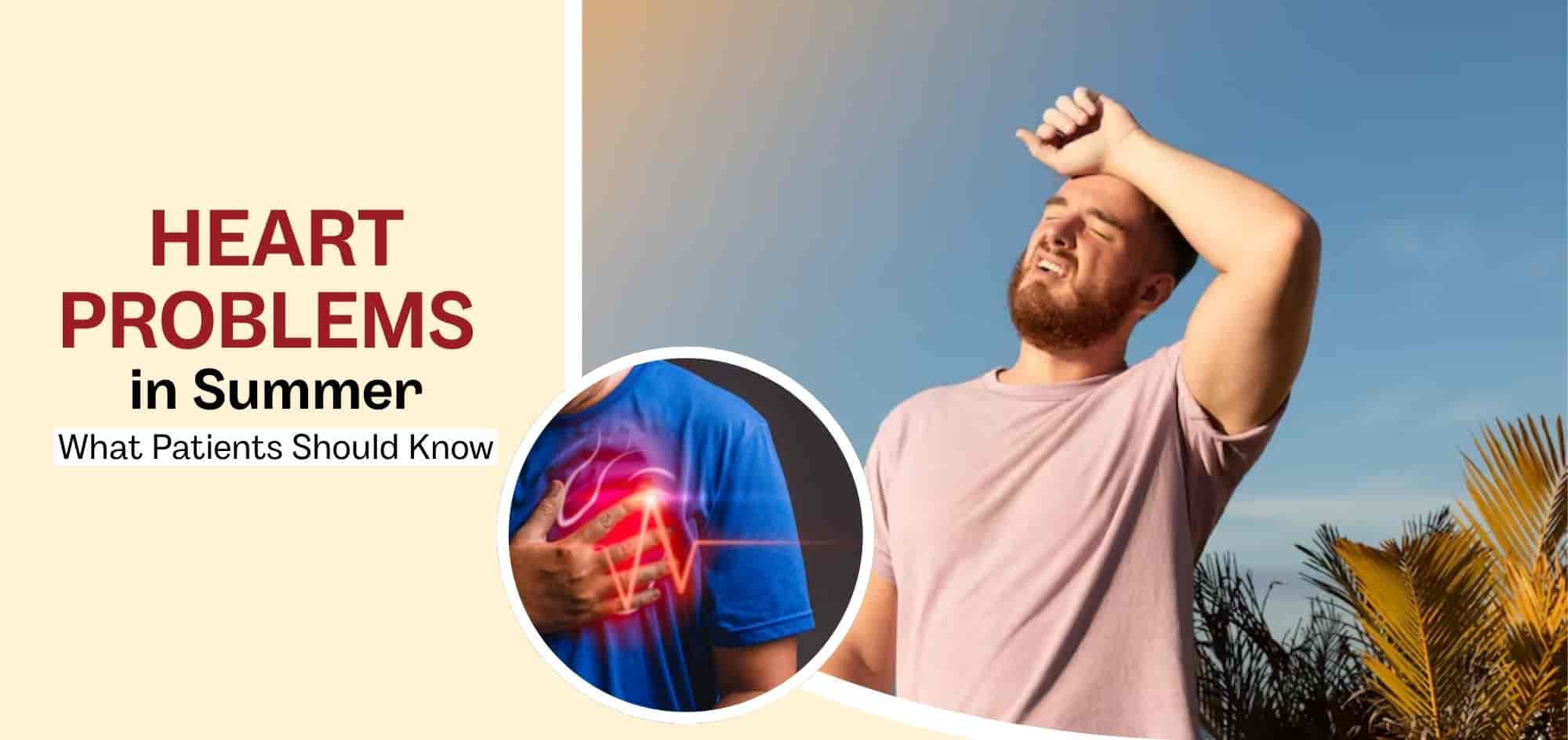 Heart problems in summer: What patients should know