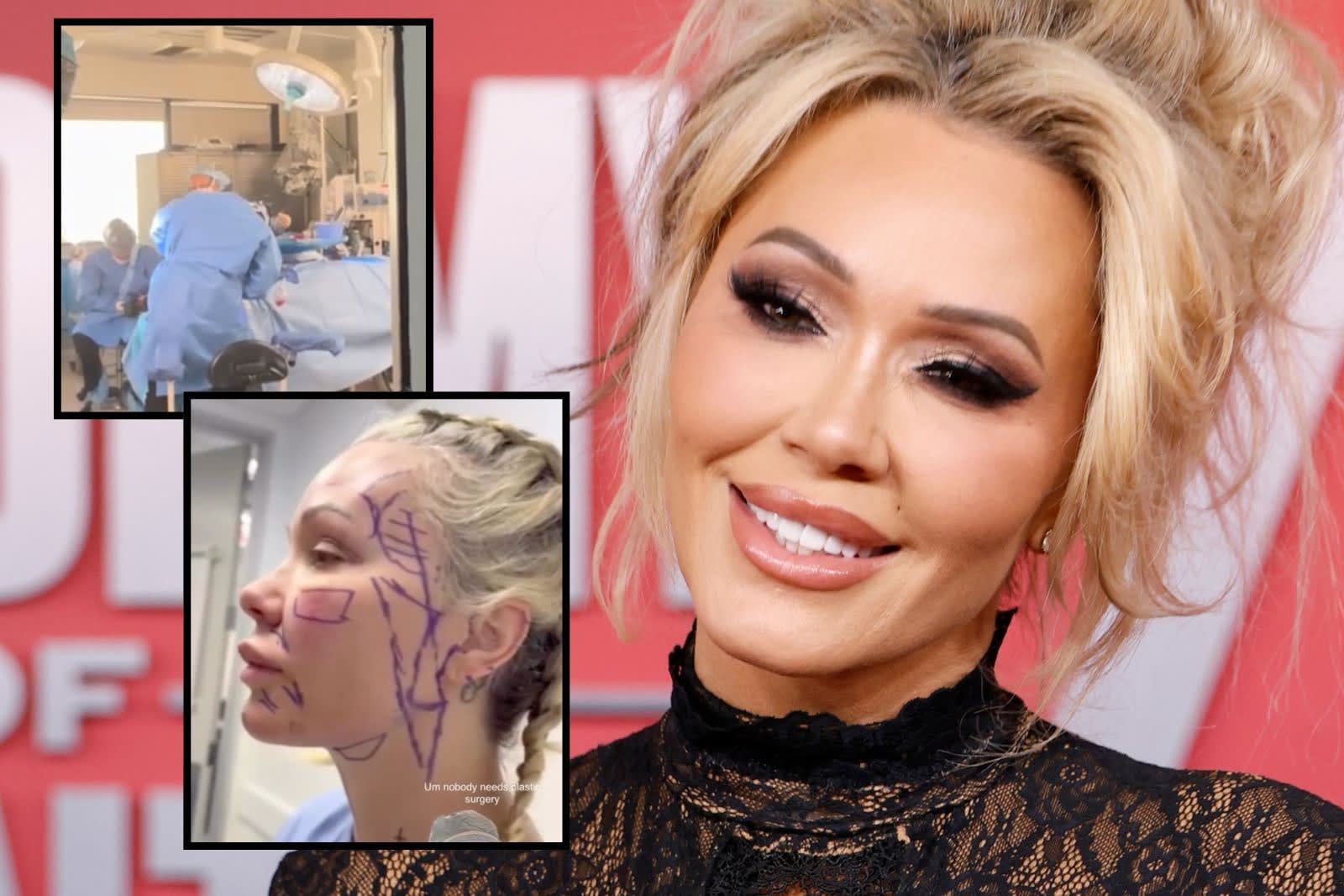 Go inside the operating room to watch Bunnie Xo’s facelift surgery [video]