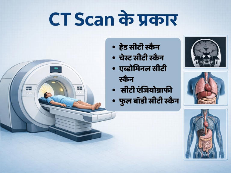 CT Scan क्या होता है? जानें डॉक्टर इस टेस्ट को कराने की कब देते हैं सलाह