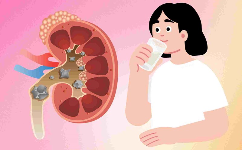 Muốn thận khỏe lâu dài, hãy duy trì những thói quen đơn giản này mỗi ngày
