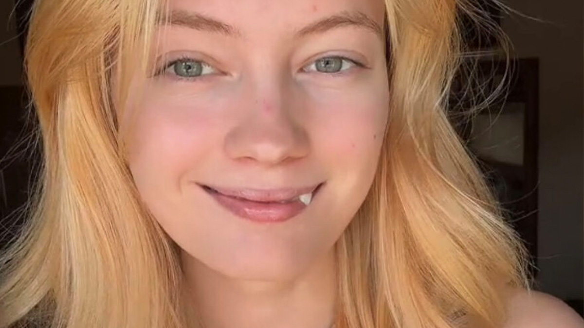 37 Beautiful Photos Showing People Celebrating What Makes Them Unique