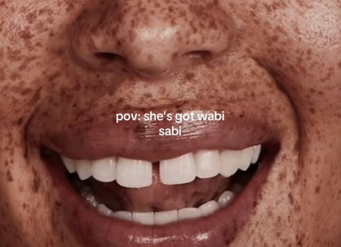 37 Beautiful Photos Showing People Celebrating What Makes Them Unique