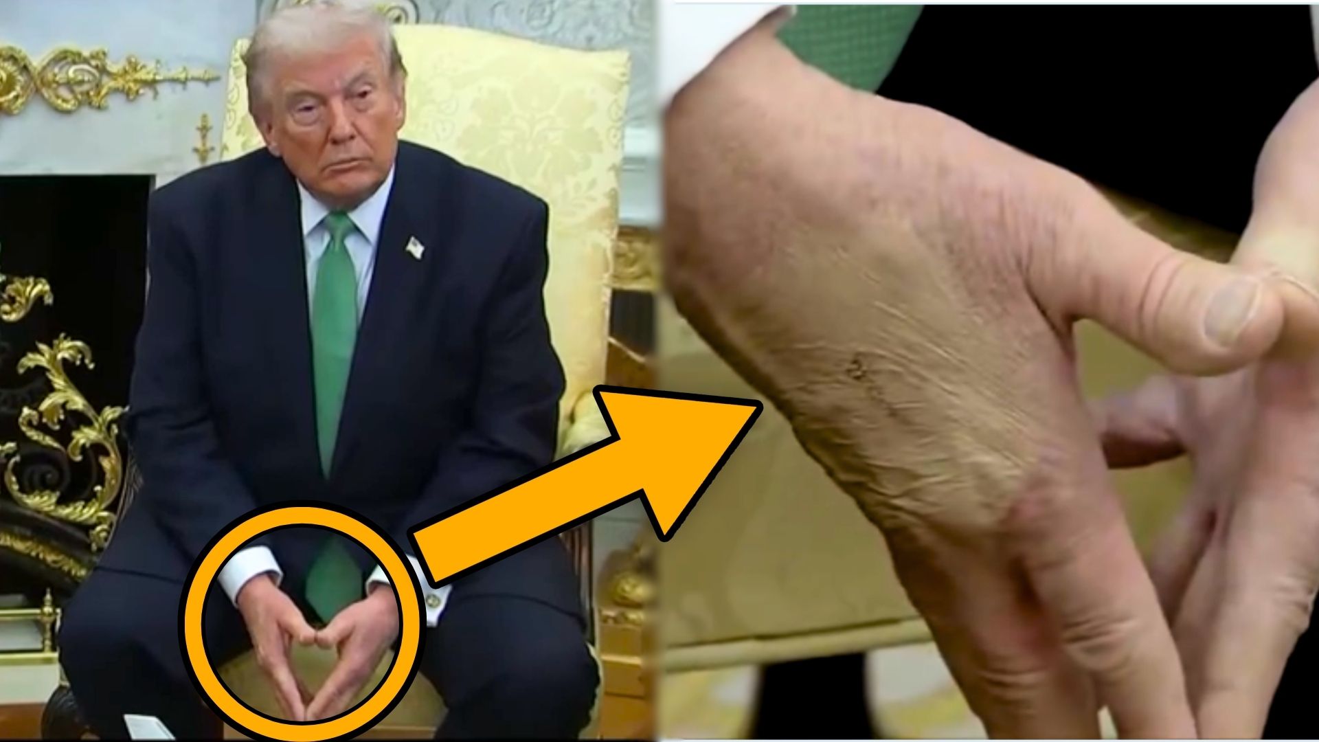 Video of Trump’s hand sparks speculation