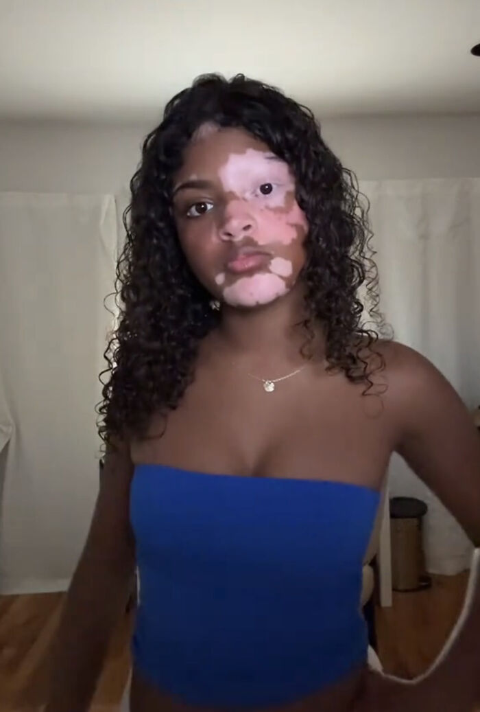 37 Beautiful Photos Showing People Celebrating What Makes Them Unique