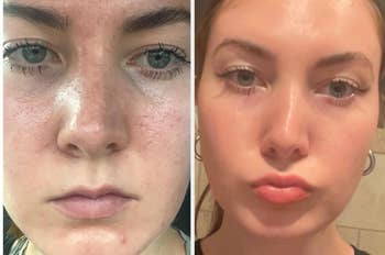 34 K-Beauty Products That Deliver Magical Results