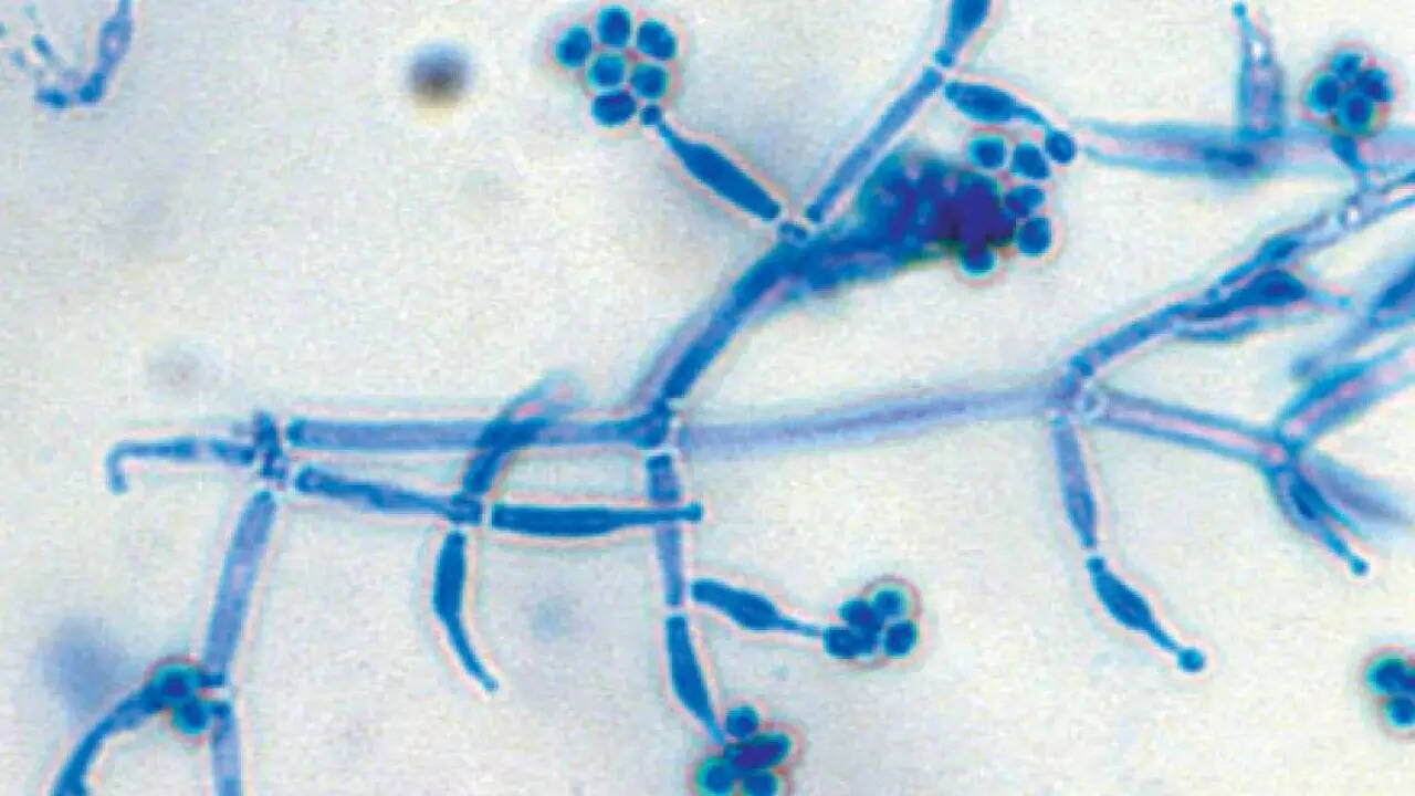How to use Trichoderma to protect home plants from root diseases and ...