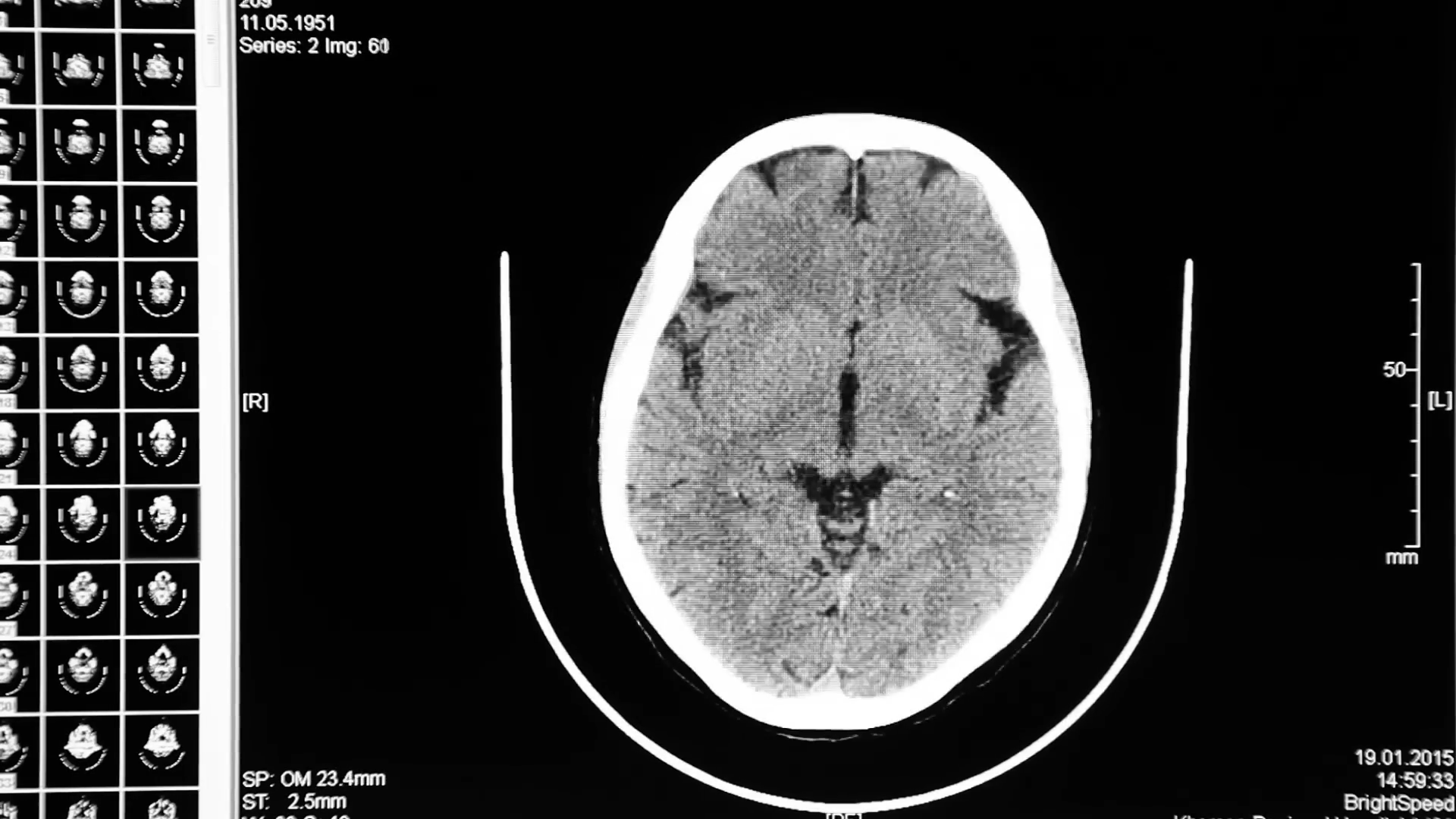 This device can turn parts of your brain on and off