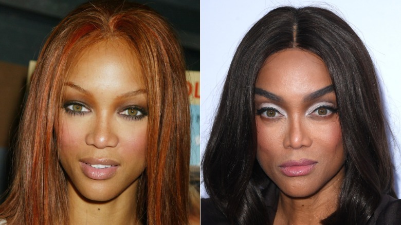 Before-and-after pics show just how much Tyra Banks' face has changed