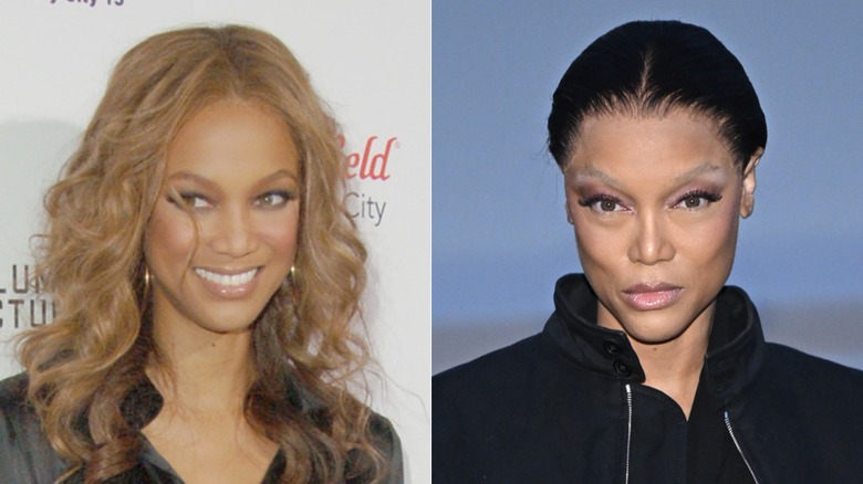 Before-and-after pics show just how much Tyra Banks' face has changed