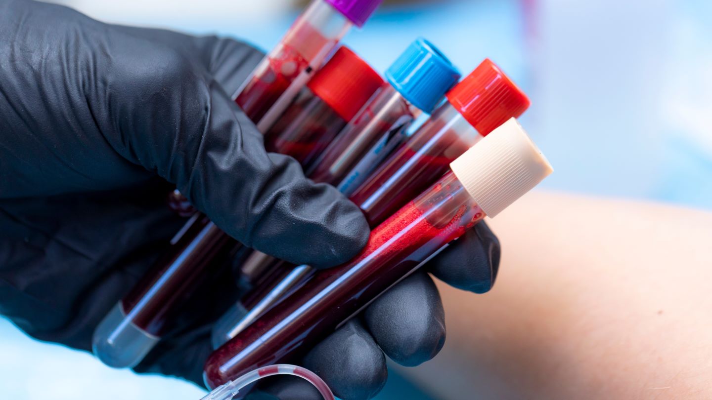 Vitestro raises $70M to fuel blood-drawing robot’s global commercial ...