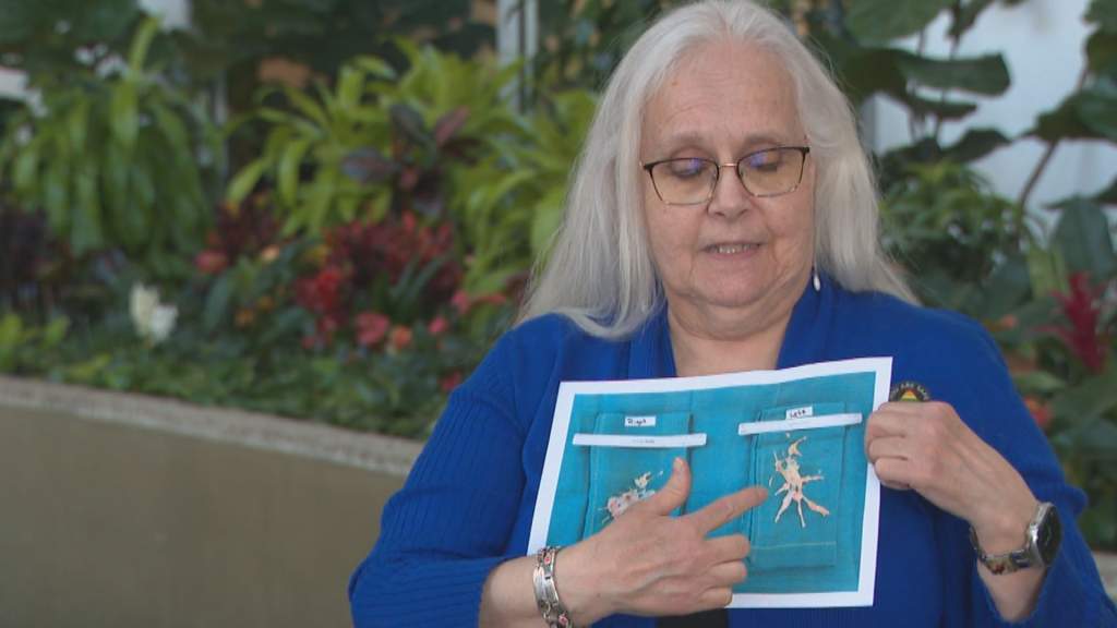 Edmonton team allows Alberta lung patient to receive care closer to home
