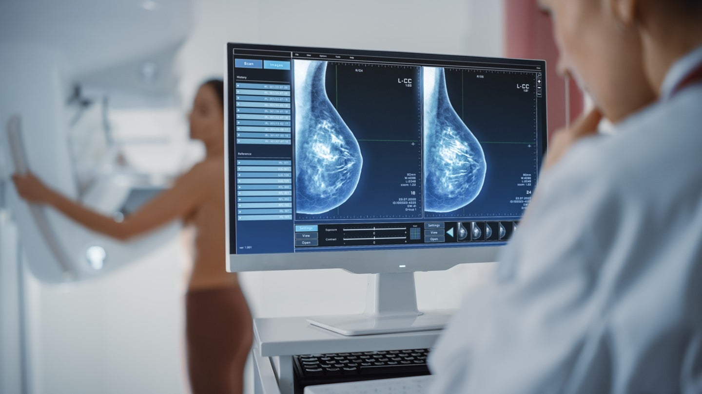 QT Imaging secures FDA clearance for updated breast acoustic CT scanner