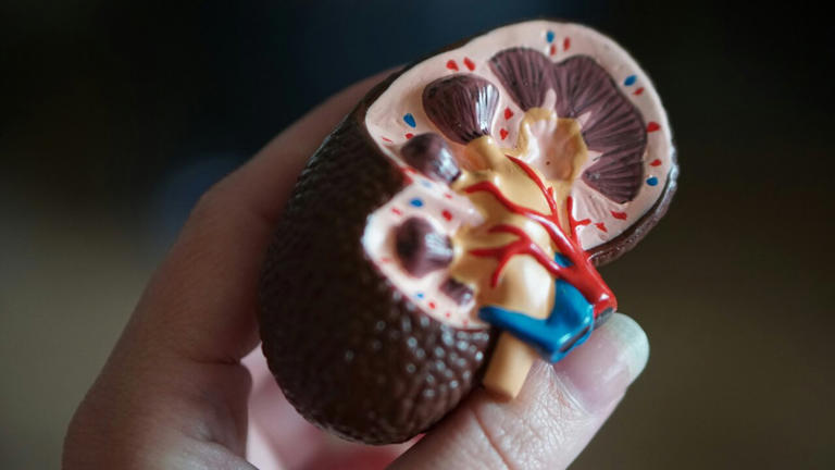 Up to half of life-threatening kidney disease cases may go undiagnosed